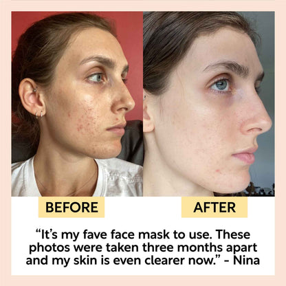 Kaolin Clay Face Mask